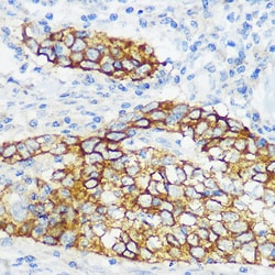 Invitrogen COL17A1 Recombinant Rabbit Monoclonal Antibody (8W2C8) 100 &mu;L:Antibodies,