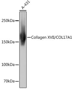 Invitrogen COL17A1 Recombinant Rabbit Monoclonal Antibody (8W2C8) 100 &mu;L:Antibodies,