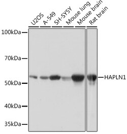 HAPLN1 Recombinant Rabbit Monoclonal Antibody (5O9U2) 100 &mu;L:Antibodies,