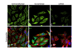 Invitrogen Calnexin Recombinant Rabbit Monoclonal Antibody (5S3U3) 100