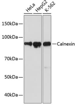 Invitrogen Calnexin Recombinant Rabbit Monoclonal Antibody (5S3U3) 100
