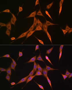 Invitrogen RhoA/RhoB/RhoC Recombinant Rabbit Monoclonal Antibody (7X5I9)