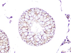 Invitrogen RhoA/RhoB/RhoC Recombinant Rabbit Monoclonal Antibody (7X5I9)