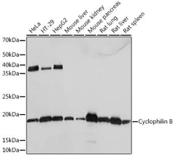 Cyclophilin B Recombinant Rabbit Monoclonal Antibody (7Z4S7) 100 &mu;L:Antibodies,