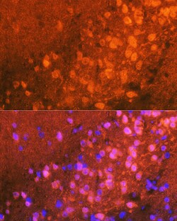 Invitrogen JNK1/JNK2/JNK3 Recombinant Rabbit Monoclonal Antibody (0J5D8)
