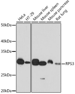 Invitrogen RPS3 Recombinant Rabbit Monoclonal Antibody (3X2M4) 100 &mu;L | Buy Online | Invitrogen&trade; | Fisher Scientific