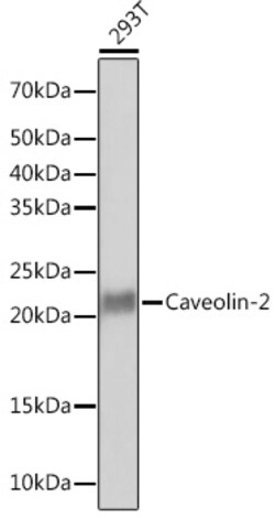 Caveolin 2 Recombinant Rabbit Monoclonal Antibody (8I4U7) 100 &mu;L | Buy Online | Thermo Scientific | Fisher Scientific