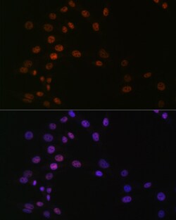 Invitrogen ASH2L Recombinant Rabbit Monoclonal Antibody (10B6U5) 100 &mu;L:Antibodies,
