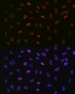 Invitrogen ASH2L Recombinant Rabbit Monoclonal Antibody (10B6U5) 100 &mu;L:Antibodies,