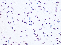 Invitrogen ASH2L Recombinant Rabbit Monoclonal Antibody (10B6U5) 100 &mu;L:Antibodies,