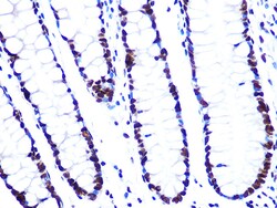Invitrogen ASH2L Recombinant Rabbit Monoclonal Antibody (10B6U5) 100 &mu;L:Antibodies,