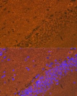 Invitrogen Synuclein alpha/beta Recombinant Rabbit Monoclonal Antibody