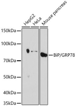 Invitrogen GRP78 Recombinant Rabbit Monoclonal Antibody (8J5M2) 100 &mu;L;
