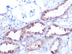 Invitrogen Cytochrome C Recombinant Rabbit Monoclonal Antibody (6R10F3)
