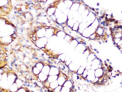 Invitrogen Clathrin Heavy Chain Recombinant Rabbit Monoclonal Antibody (9M2G2) 100 &mu;L | Buy Online | Invitrogen&trade; | Fisher Scientific