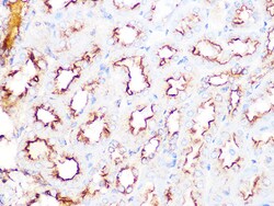 Invitrogen Clathrin Heavy Chain Recombinant Rabbit Monoclonal Antibody (9M2G2) 100 &mu;L | Buy Online | Invitrogen&trade; | Fisher Scientific
