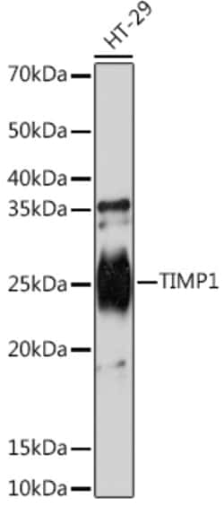 Invitrogen TIMP1 Recombinant Rabbit Monoclonal Antibody (5O7P1) 100 &mu;L | Buy Online | Invitrogen&trade; | Fisher Scientific