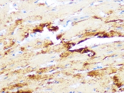 Invitrogen Myosin Heavy Chain Recombinant Rabbit Monoclonal Antibody (6V0G1)