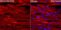 Invitrogen Myosin Heavy Chain Recombinant Rabbit Monoclonal Antibody (6V0G1)