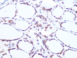 Invitrogen Lamin B2 Recombinant Rabbit Monoclonal Antibody (1S9M6) 100