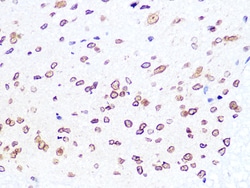 Invitrogen Lamin B2 Recombinant Rabbit Monoclonal Antibody (1S9M6) 100