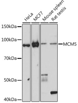Invitrogen MCM5 Recombinant Rabbit Monoclonal Antibody (4P1Q5) 100 &mu;L:Antibodies,