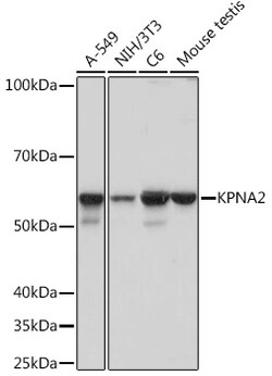 Invitrogen KPNA2 Recombinant Rabbit Monoclonal Antibody (9T3V8) 100 &mu;L:Antibodies,