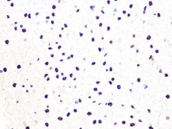Invitrogen DDB1 Recombinant Rabbit Monoclonal Antibody (9L8X5) 100 &mu;L:Antibodies,