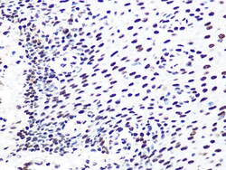 Invitrogen DDB1 Recombinant Rabbit Monoclonal Antibody (9L8X5) 100 &mu;L:Antibodies,