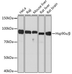 Invitrogen HSP90 Recombinant Rabbit Monoclonal Antibody (5D7Y6) 100 &mu;L | Buy Online | Invitrogen&trade; | Fisher Scientific