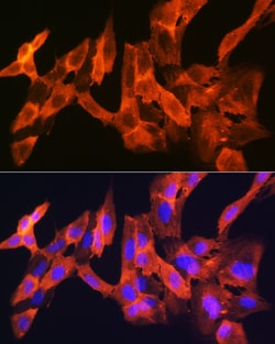 Invitrogen JNK1/JNK3 Recombinant Rabbit Monoclonal Antibody (8Q7S4) 100 &mu;L | Buy Online | Invitrogen&trade; | Fisher Scientific