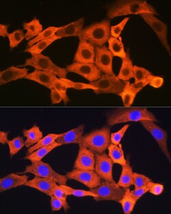 Invitrogen JNK1/JNK3 Recombinant Rabbit Monoclonal Antibody (8Q7S4) 100 &mu;L | Buy Online | Invitrogen&trade; | Fisher Scientific