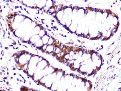 Invitrogen Cullin 4A Recombinant Rabbit Monoclonal Antibody (5P4M1) 100