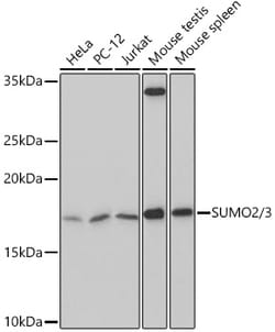 Invitrogen SUMO2/SUMO3 Recombinant Rabbit Monoclonal Antibody (6R8G7) 100