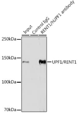 Invitrogen UPF1 Recombinant Rabbit Monoclonal Antibody (5D5C4) 100 &mu;L | Buy Online | Invitrogen&trade; | Fisher Scientific