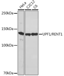 Invitrogen UPF1 Recombinant Rabbit Monoclonal Antibody (5D5C4) 100 &mu;L | Buy Online | Invitrogen&trade; | Fisher Scientific