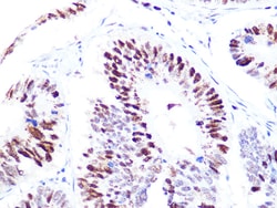 Invitrogen CAF1 p60 Recombinant Rabbit Monoclonal Antibody (7N0I2) 100