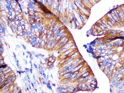 Invitrogen PAR2 Recombinant Rabbit Monoclonal Antibody (9X8E6) 100 &mu;L:Antibodies,