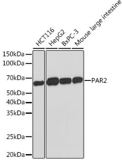 Invitrogen PAR2 Recombinant Rabbit Monoclonal Antibody (9X8E6) 100 &mu;L:Antibodies,