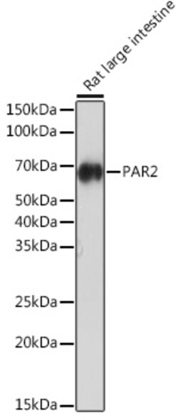 Invitrogen PAR2 Recombinant Rabbit Monoclonal Antibody (9X8E6) 100 &mu;L:Antibodies,