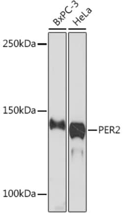 Invitrogen PER2 Recombinant Rabbit Monoclonal Antibody (2K9Y0) 100 &mu;L;