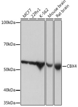 Invitrogen CBX4 Recombinant Rabbit Monoclonal Antibody (1R5G6) 100 &mu;L | Buy Online | Invitrogen&trade; | Fisher Scientific