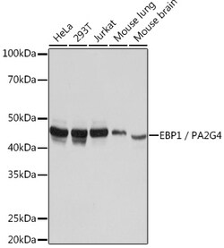 Invitrogen EBP1 Recombinant Rabbit Monoclonal Antibody (9J9U5) 100 &mu;L | Buy Online | Invitrogen&trade; | Fisher Scientific