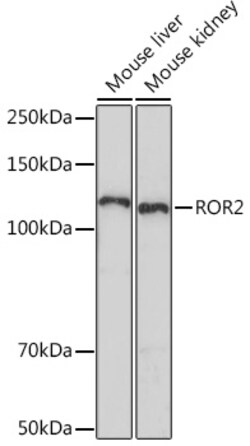 Invitrogen ROR2 Recombinant Rabbit Monoclonal Antibody (0B7X8) 100 &mu;L | Buy Online | Invitrogen&trade; | Fisher Scientific