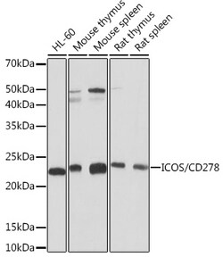 Invitrogen ICOS Recombinant Rabbit Monoclonal Antibody (7H1F7) 100 &mu;L;