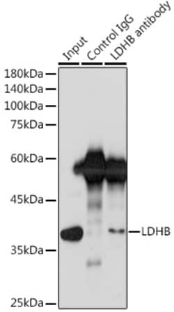 Invitrogen LDHB Recombinant Rabbit Monoclonal Antibody (6B5I2) 100 &mu;L:Antibodies,