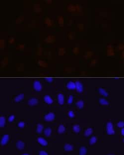 Invitrogen MBNL1 Recombinant Rabbit Monoclonal Antibody (7N6W3) 100 &mu;L;
