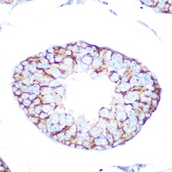 Invitrogen CHRM2 Recombinant Rabbit Monoclonal Antibody (3T5W8) 100 &mu;L | Buy Online | Invitrogen&trade; | Fisher Scientific