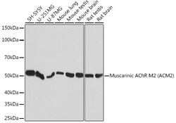 Invitrogen CHRM2 Recombinant Rabbit Monoclonal Antibody (3T5W8) 100 &mu;L | Buy Online | Invitrogen&trade; | Fisher Scientific