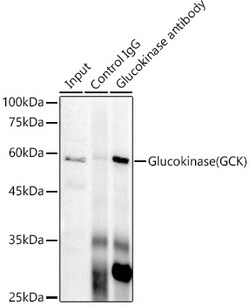 Invitrogen GCK Recombinant Rabbit Monoclonal Antibody (4K9D5) 100 &mu;L;